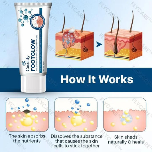 CASSIDY FootGlow Remove gel, 75gm (Pack of 1)